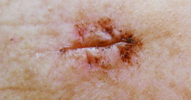 Dr. Sandhofer, Linz, Austria -before