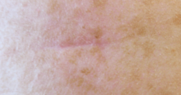 Dr. Sandhofer, Linz, Austria - After