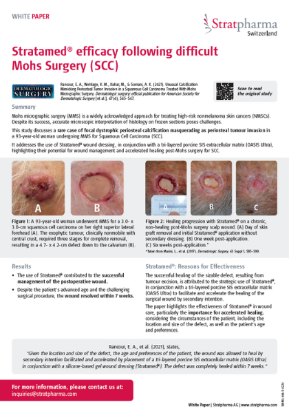 Stratamed® efficacy following difficult  Mohs Surgery (SCC)